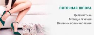 Пяточная шпора